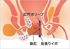 主な症状