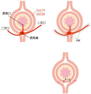 開放